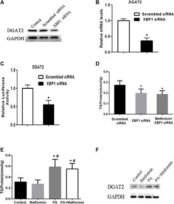 X-box binding protein 1: A new metabolic mediator and drug target of metformin?